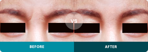 ָ̰ 